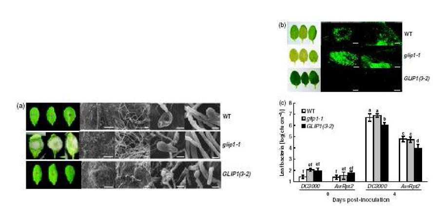 glip1, 35S:GLI P 1 식물체의 다양한 병원균에 대한 저항성 기능 조사