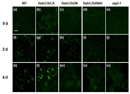 RabG3bCA 과발현에 의한 도관세포의 자가포식 유도