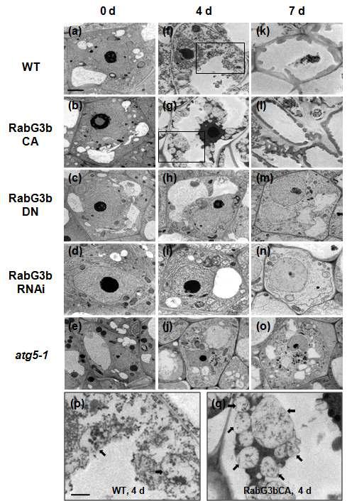 RabG3bCA 과발현에 의한 자가포식 구조물 형성 유도