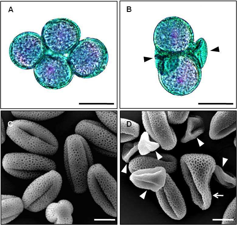 Bright Microscopy and ScanningElectron Microscopy of RNAi Pollen.