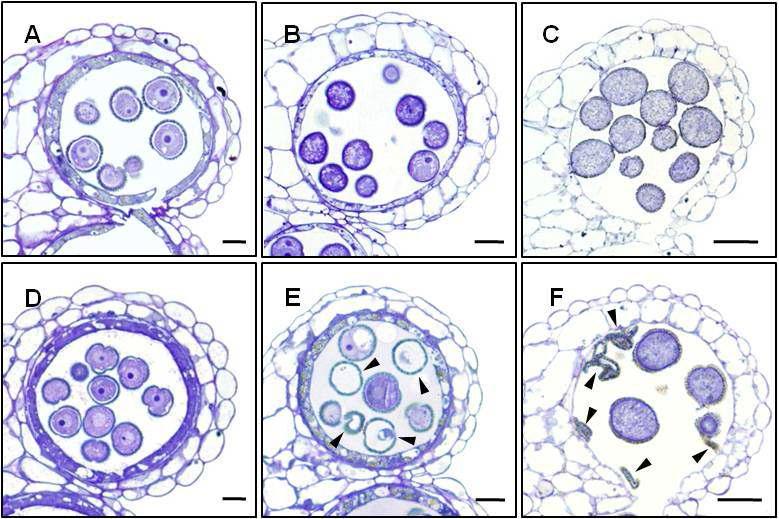 Semi-thin Section Images of RNAi Pollen