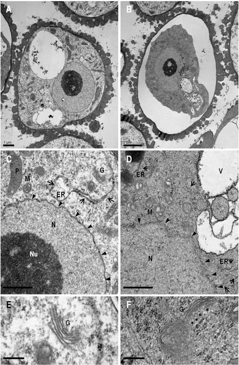 Transmission ElectronMicroscopy of RNAi Pollen