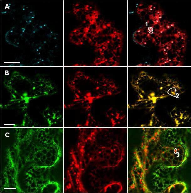 Subcellular Localization of PLA2-gin Tobacco Epidermal Cell