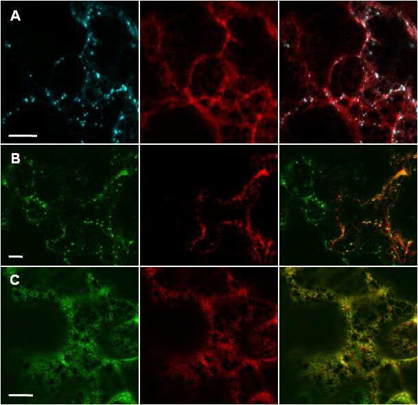 Subcellular Localization of PLA2-δin Tobacco Epidermal Cell.