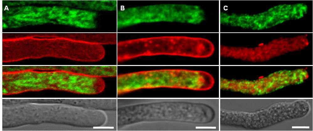 Aggregation of VHA-c4:smRS-GFP by Treatmentwith PLA2 Inhibitor in Arabidopsis Pollen.