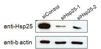 anti-Hsp25 항체를 이용하여 Hsp25 siRNA에 의한 Hsp25의 감소를 확인.