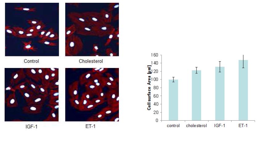 Cholesterol 처리시 cardiomyoblast cell size 증가 관찰
