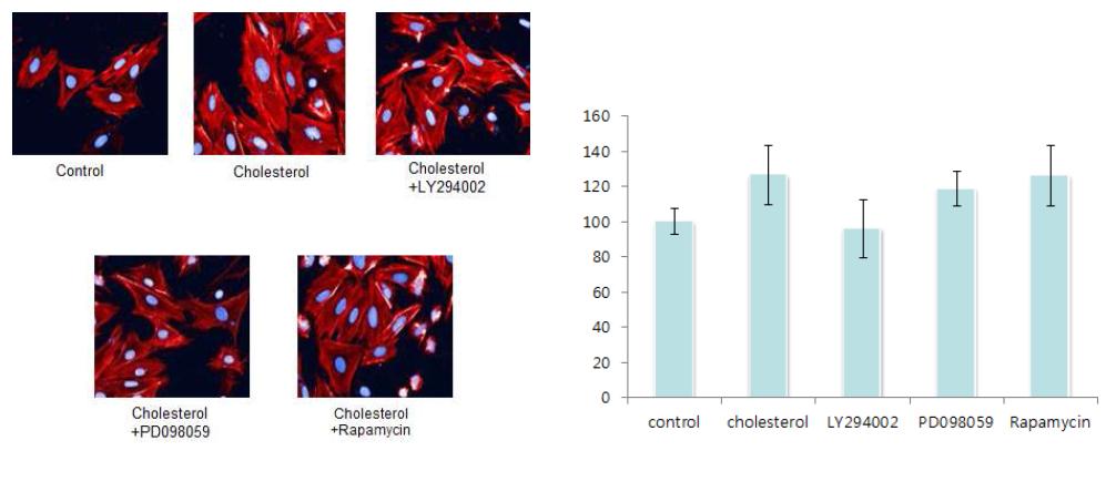 Cholesterol과 cardiac hypertrophy 관련 신호전달 단백질들의 저해제를 동시 처리한 H9c2 cell의 size 변화 관찰