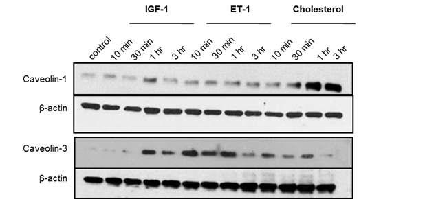 Cholesterol이 caveolin-1, caveolin-3 단백질 활성에 관여 하는지 관찰