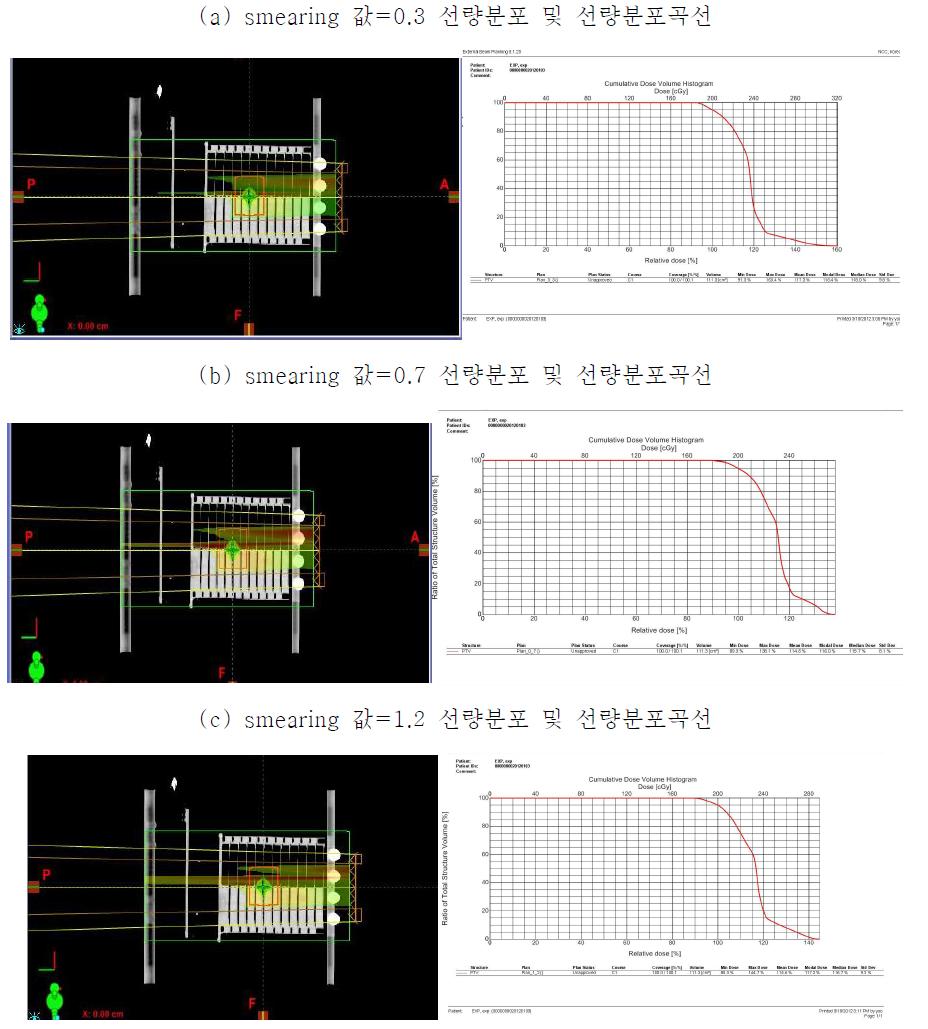 smearing 효과에 따른 선량분포 및 선량분포곡선