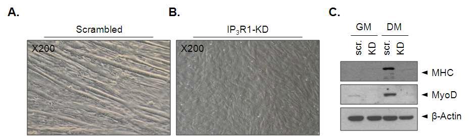 IP3R knock-down 근원세포주의 미분화현상
