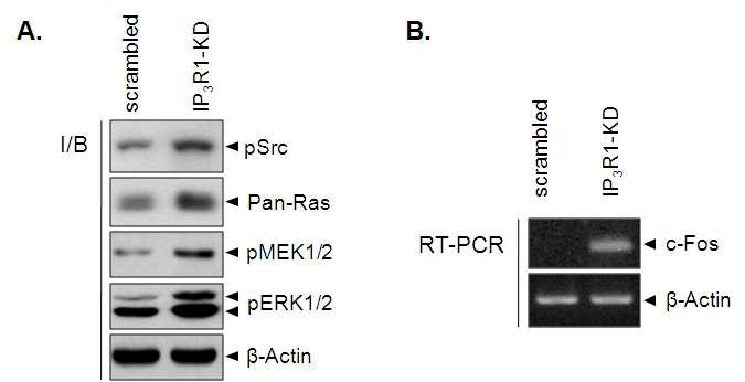 IP3R knock-down 근원세포주의 ERK pathway 활성화