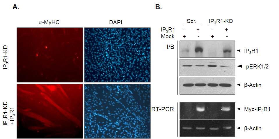 IP3R knock-down 근원세포주에서 IP3R의 과발현으로 인한 분화능 회복