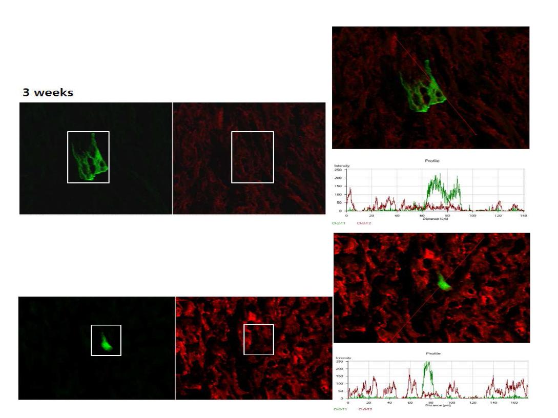 Knockdown of PKA gene expression in AAV9-transduced mouse cardiomyocytes. AAV9 vector expression was assessed by GFP direct fluorescence(green), and the expression of PKA gene was examined by immunostaining(rhodamine:red).