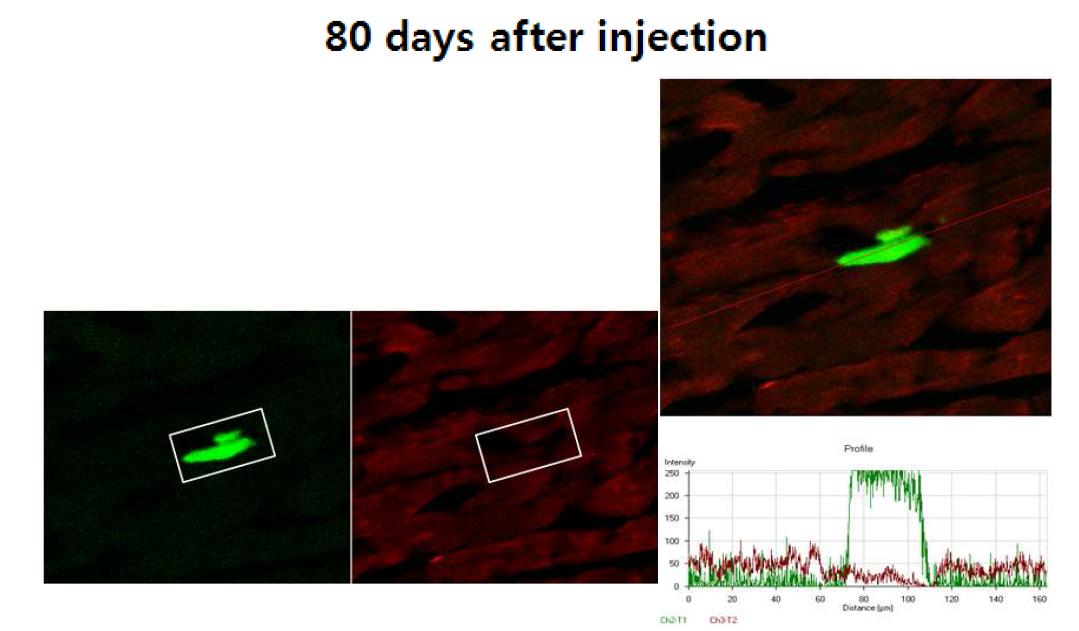 Knockdown of PKA gene expression in AAV9-transduced mouse cardiomyocytes. AAV9 vector expression was assessed by GFP direct fluorescence(green), and the expression of PKA gene was examined by immunostaining(rhodamine:red).