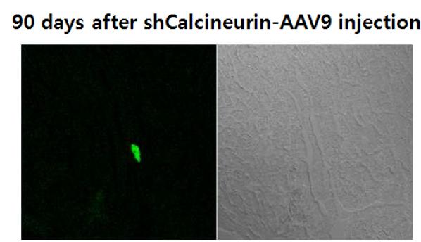 Representative photomicrographs of sections from mouse heart 90 days after systemic injection of 60 ul containing 6 x 10^10 vg of shRNA-expressing AAV9.