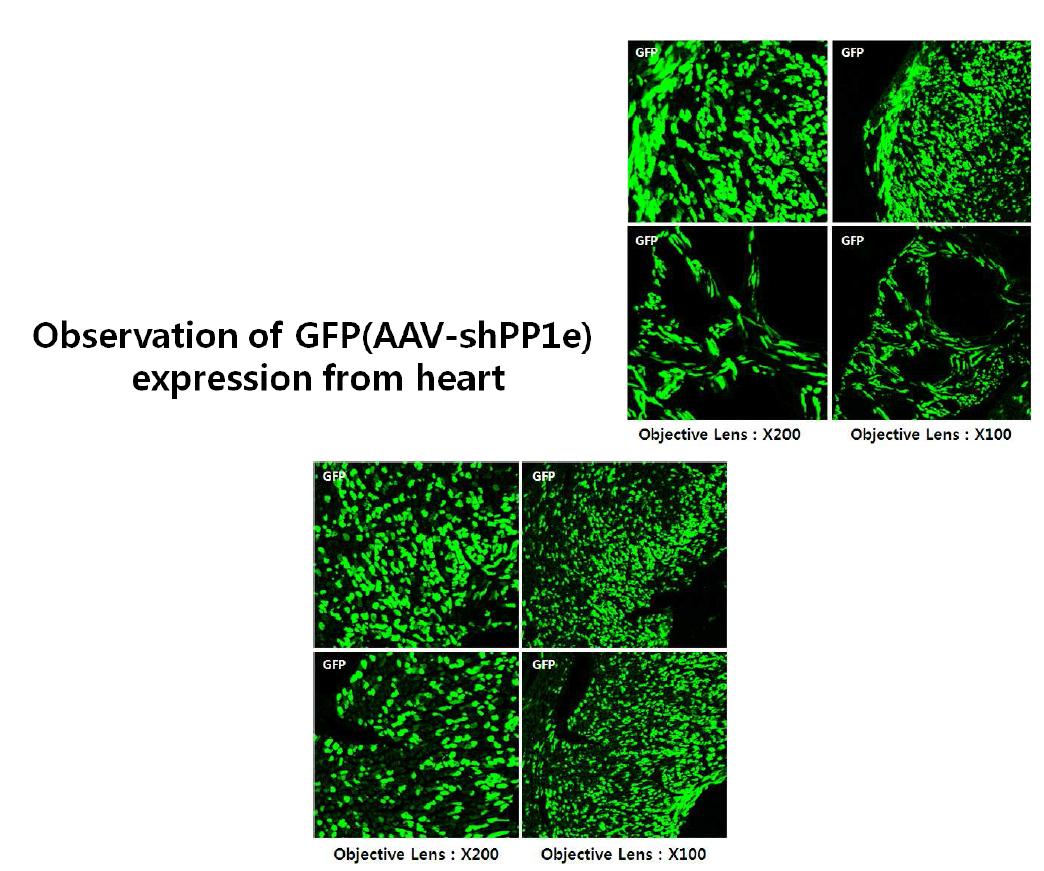 Representative photomicrographs of sections from mouse heart 21 days after systemic injection of AAV-shPP1e.