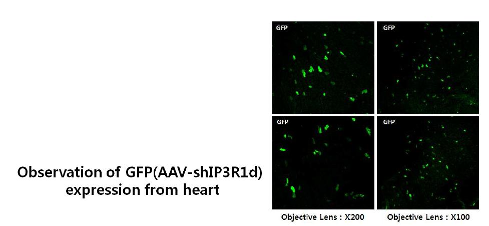 Representative photomicrographs of sections from mouse heart 21 days after systemic injection of AAV9-shIP3R1d.