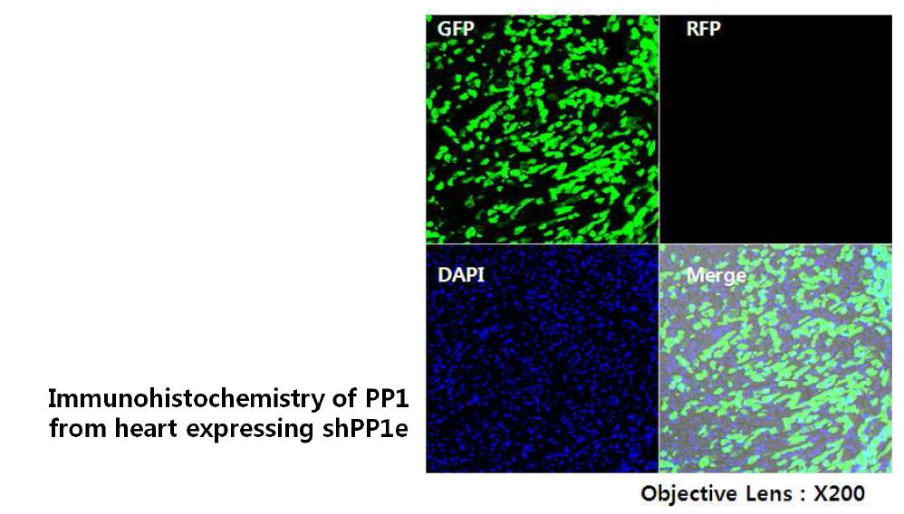 Immunostaining of PP1 from heart expressing AAV-shPP1e.