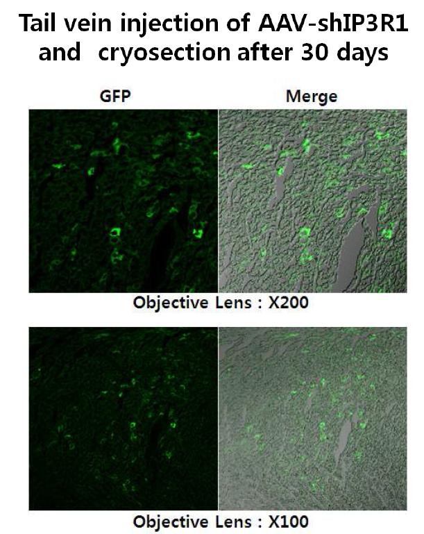 Representative photomicrographs of sections from mouse heart 30 days after tail vein injection of AAV9-shIP3R1d