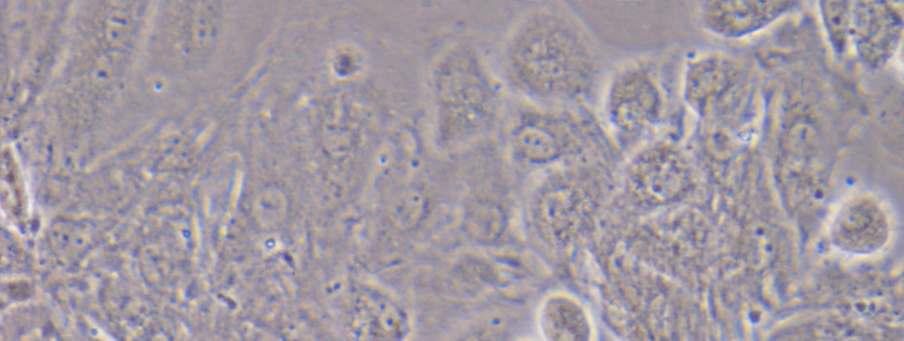 Primary mouse cardiomyocyte culture showing beating cells. Picture was taken 10 days after starting culture