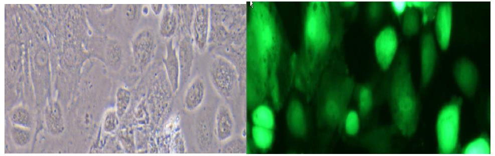 그림 36 Primary mouse cardiomyocyte culture showing cells infected with GFP-expressing lentiviral vector. Picture was take 3 days after lentivrial infection.