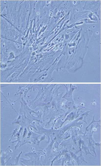 Preparation of immortalized mouse cardiomyocyte by Tert and Bmi-1. Picture was taken 21 days after starting doxycycline treatment.