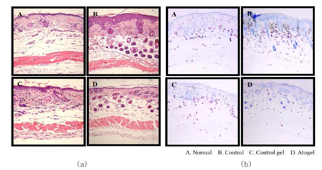 Atogel이 처리된 아토피성 피부염이 유발된 Nc/Nga mouse 등피의 조직염색사진: (a) H&E staining, (b) Toluidin B