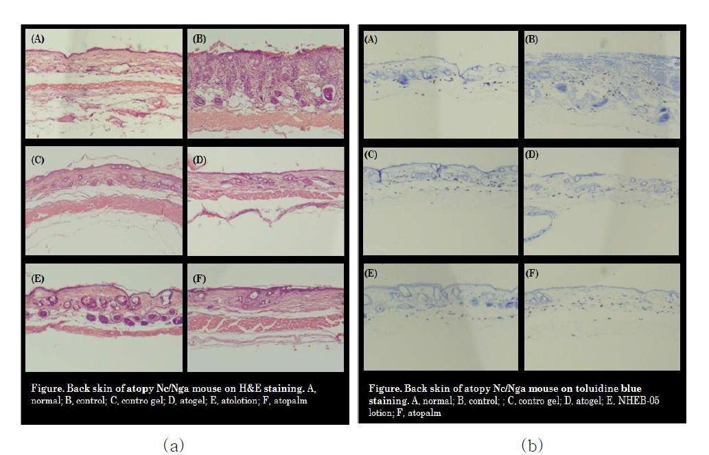 추출혼합물이 함유된 여러제형에서의 아토피성 피부염이 유발된 Nc/Nga mouse 등피의 조직염색사진(A: N. control, B: P. control, C: control gel, D: atogel, E: atolotion, F: control lotion, G: EU(두충) lotion, H: atocream, I: atopalm): (a) H&E staining, (b) Toluidin B.