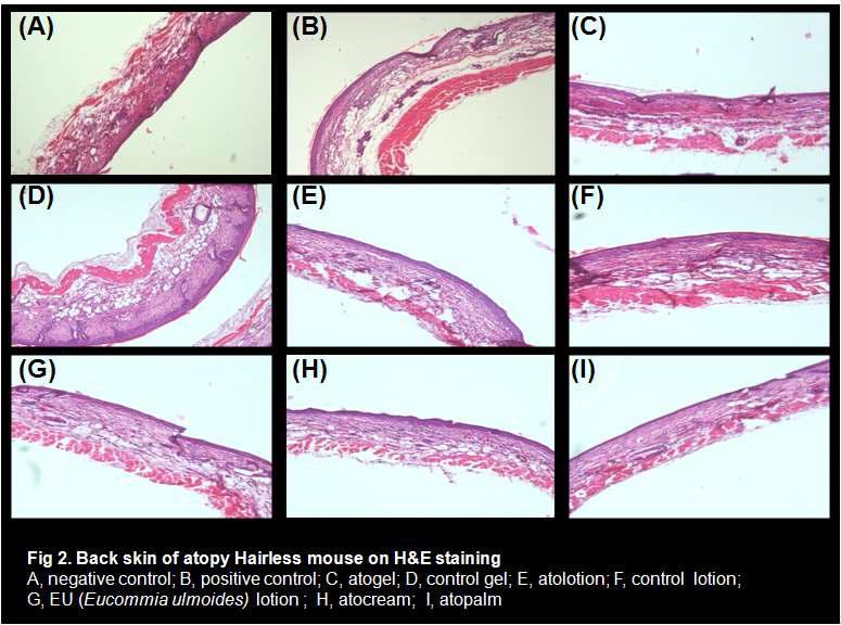 DNCB로 아토피성 피부염이 유발된 hairless mouse 등피의 조직염색사진(H&E staining. A: N. control, B: P. control, C: atogel, D: control gel, E: atolotion, F: control lotion, G: EU(두충) lotion, H: atocream, I: atopalm