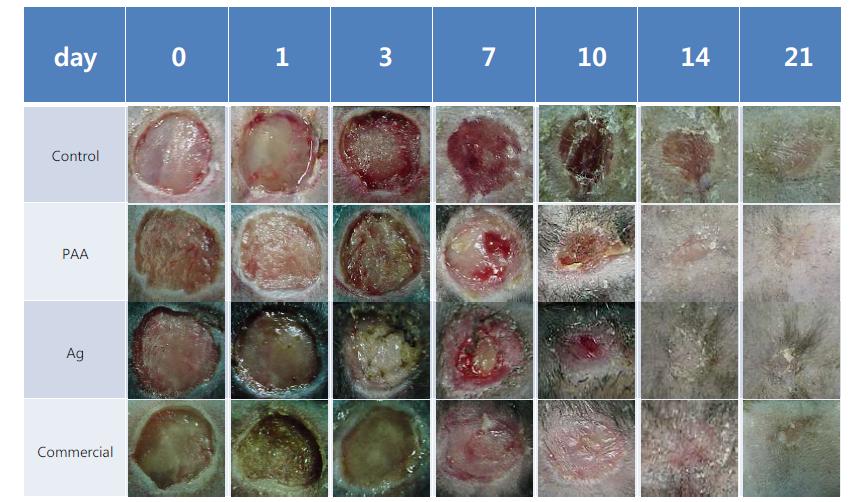 은나노입자가 포함된 하이드로겔 궤양 치료 이미지