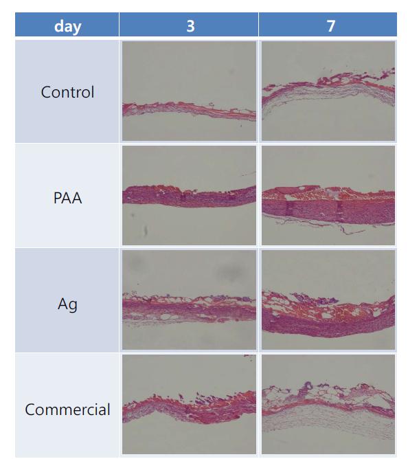 은나노입자가 포함 된 하이드로겔 처리 후 조직 염색 이미지