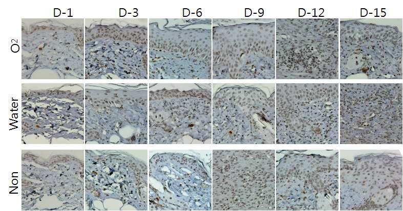 창상 생성 후 O2 hydrogel 처리에 따른 세포분열을 면역조직학적 방법을 이용하여 1, 3, 6, 9, 12, 15일째에서 항체 Ki-67의 발현을 water (positive control)과 non-treat (negative control) 함께 비교하여 보여주고 있음.