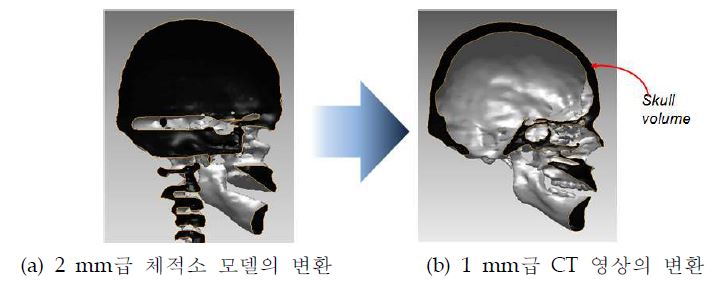 그림 3-18. 두개골의 정확한 두께표현