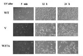 The MEFs cell lines were treated with 15 J/m2 of UV light and the cell images were captured at various time points under a microscope.