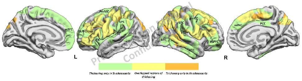 Differential cortical thickening pattern in adolescents with superior intelligence and those with average intelligence relative to young adults with average intelligence