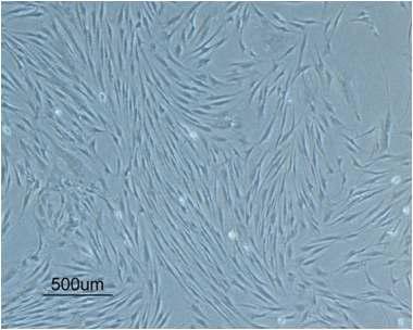 Morphology of bone-marrow mesenchymal stem cell isolated from human posterior iliac crest of the pelvic bone of normal volunteers.