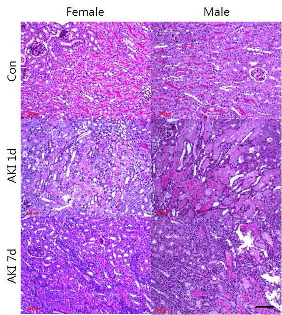 Gender differences after ischemia-reperfusion renal injury.