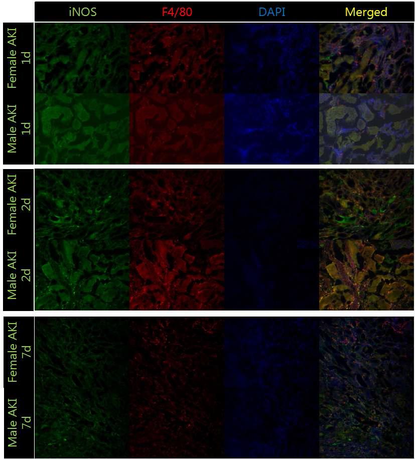 Expression of iNOS(+), F4/80(+) macrophage after acute ischema-reperfusion renal injury