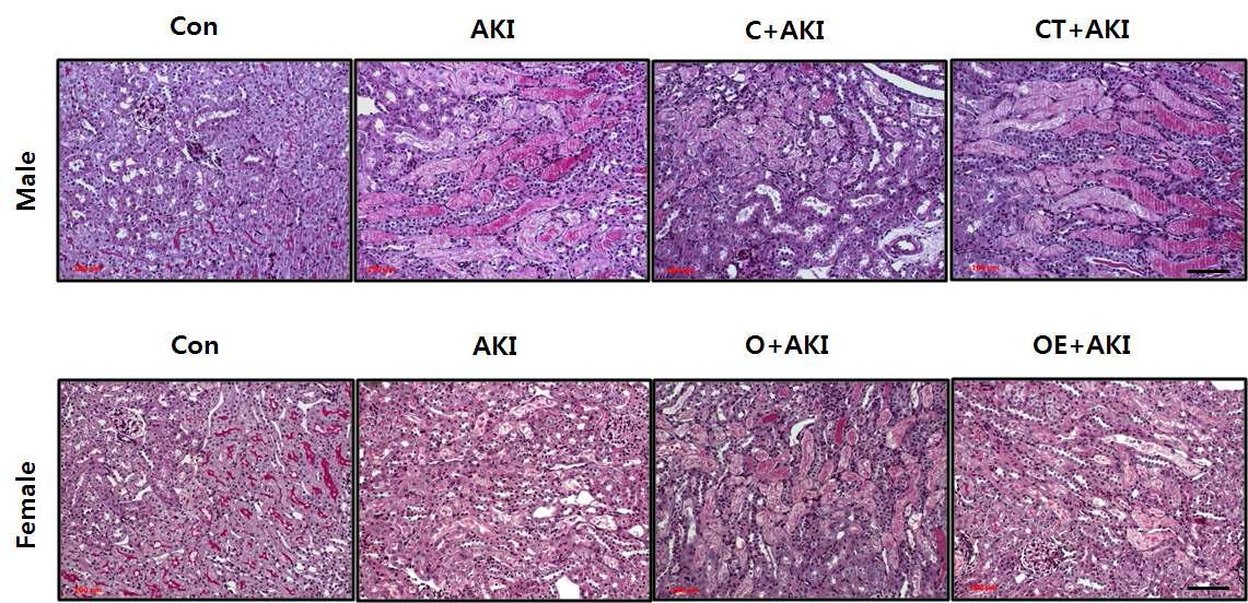 Effect of sex hormone effect on renal histology after ischemia-reperfusion injury.