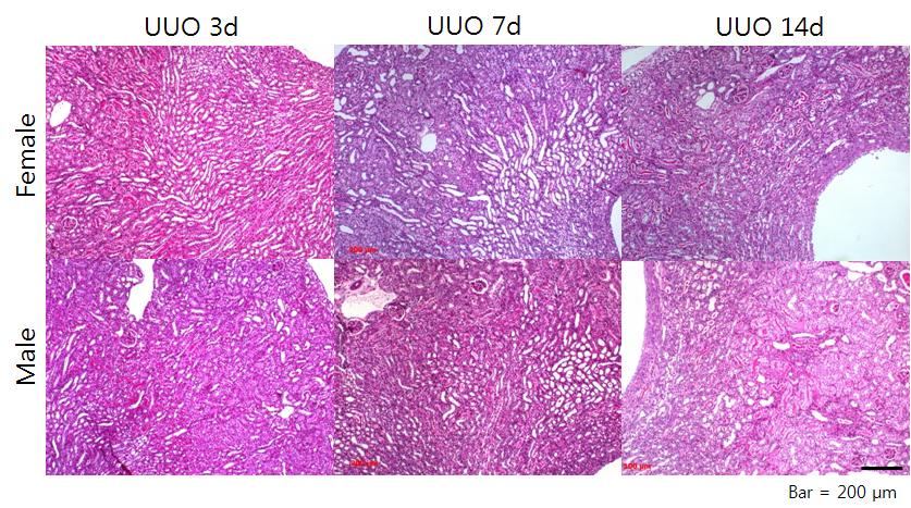 Effect of gender on renal fibrosis after unilateral ureteral obstruction model