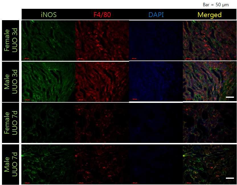 Expression of iNOS and F4/80 positive macrophage (M1) in renal fibrosis model