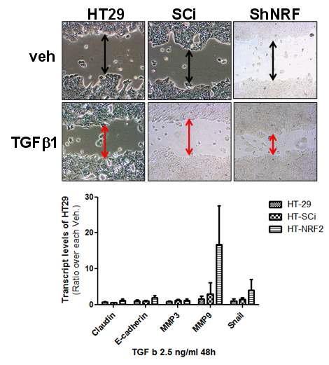 NRF2 영구 넉다운 HT29은 TGF β1에 의해 세포이동성이 증가하며 이는 MMP9의 증가를 동반함.