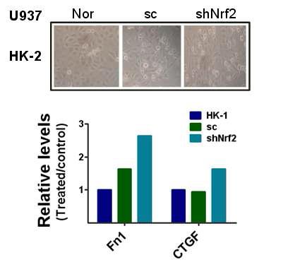 NRF2 넉다운 macrophage의 공배양은 HK2의 EMT를 촉진함.