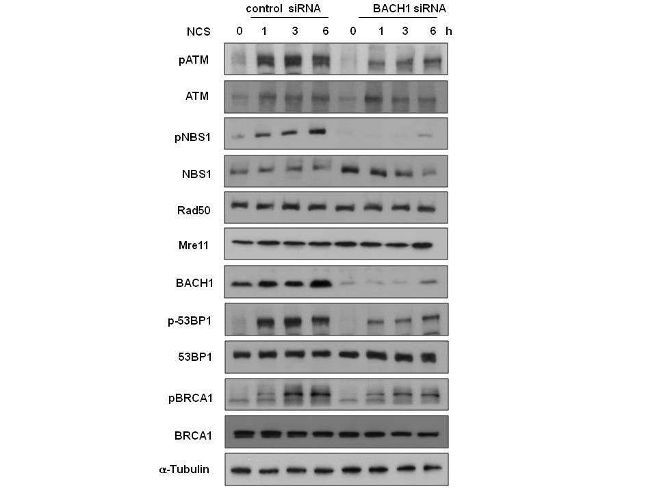 BACH1 결핍이 유전자 손상 반응 단백질의 인산화에 미치는 영향