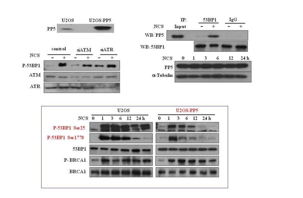 53BP1 탈인산화 단백질 PP5 발견