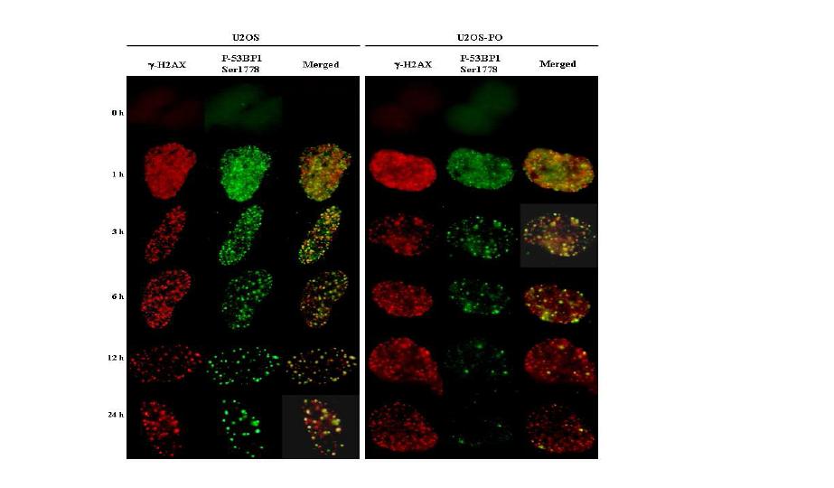 PP5가 53BP1 foci 형성에 미치는 영향