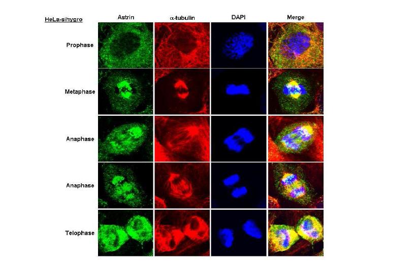 control siRNA 세포에서 DNA 분열 시 Astrin straining