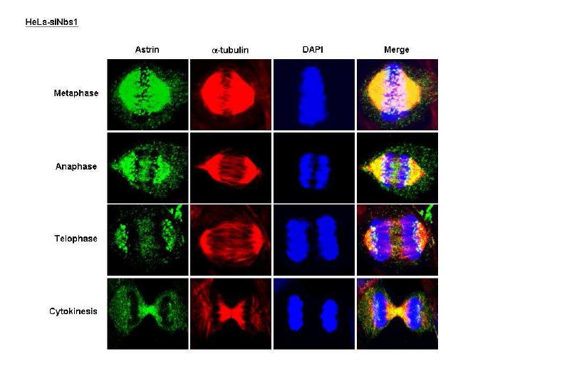 NBS1 siRNA 세포에서 DNA 분열 시 Astrin straining