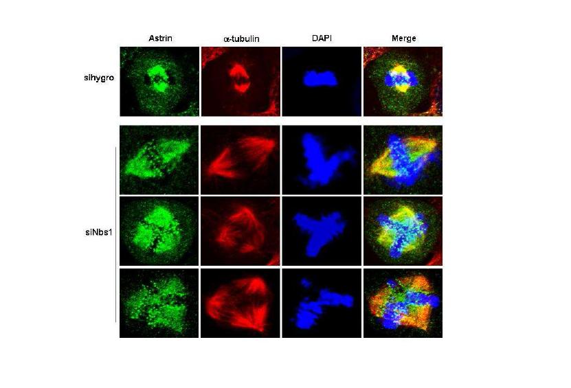 control 및 NBS1 결핍세포에서 astrin staining 양상 비교